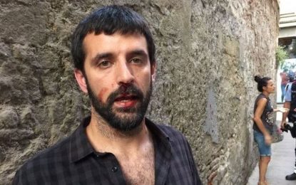 La Cristina no s’explica l’agressió que ha rebut el fotoperiodista Jordi Borràs a mans d’un policia